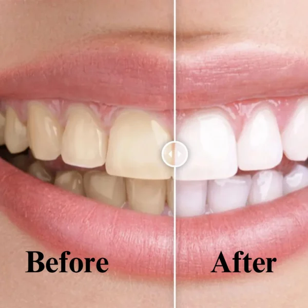 Before and After Image Comparison Plugin for WordPress